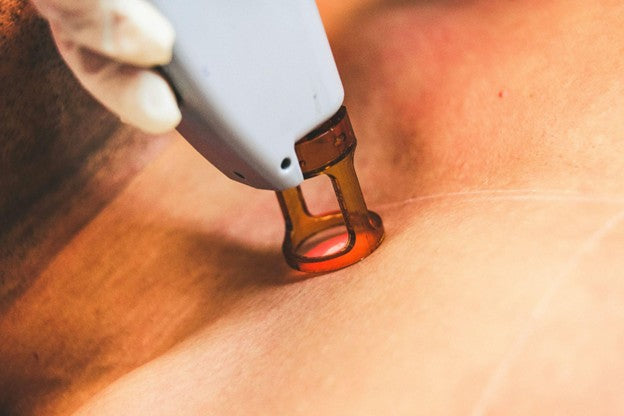 Is Laser Hair Removal Permanent? How Long It Lasts and What Affects Results