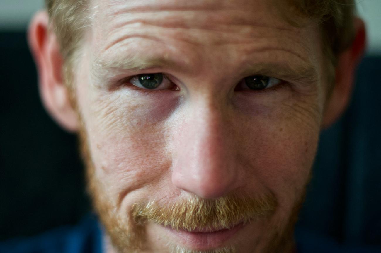 Men & Forehead Wrinkles: Causes & How to Get Rid of Them